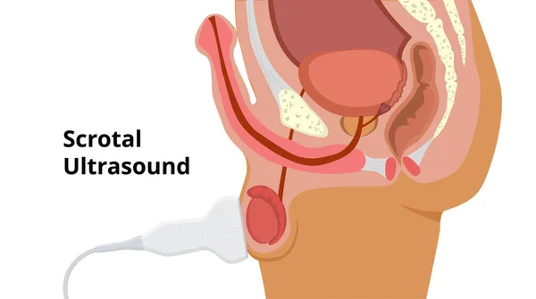 Ultrasonido testicular