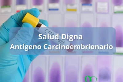 antigeno carcinoembrionario precio