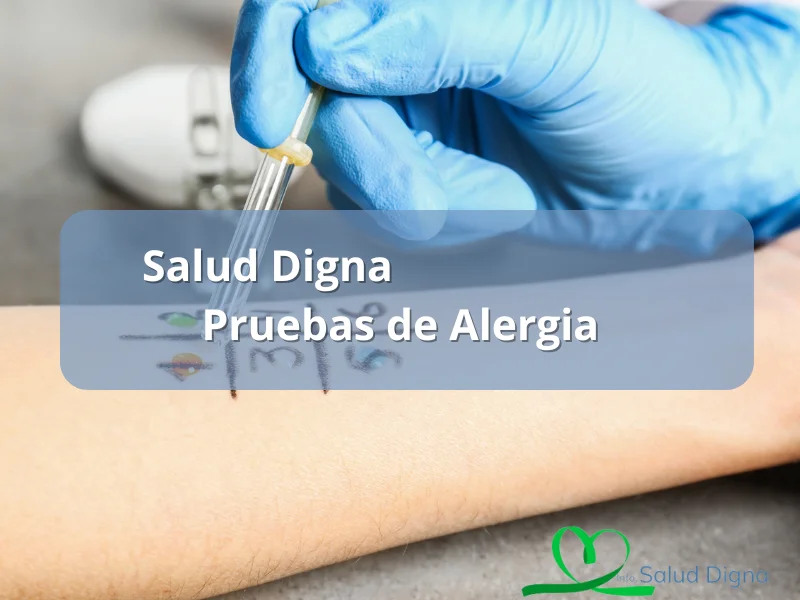 alergólogo salud digna