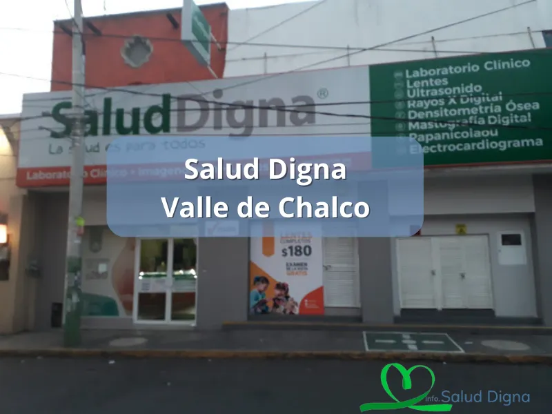 salud digna valle de chalco