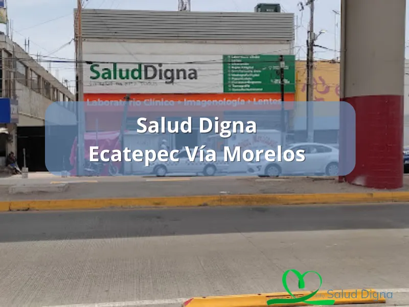 Telefono Salud Digna Ecatepec Via Morelos