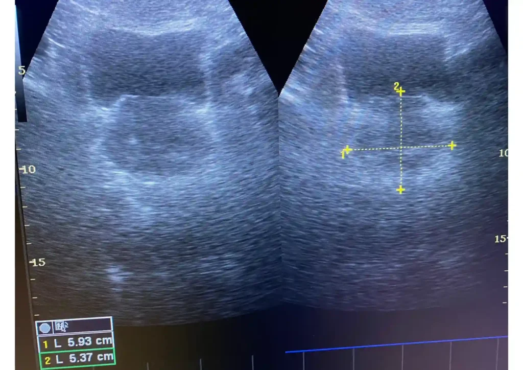 ultrasonido de testículos precio salud digna