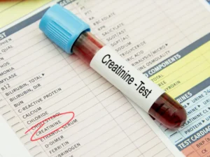 precio de estudio de creatinina en salud digna