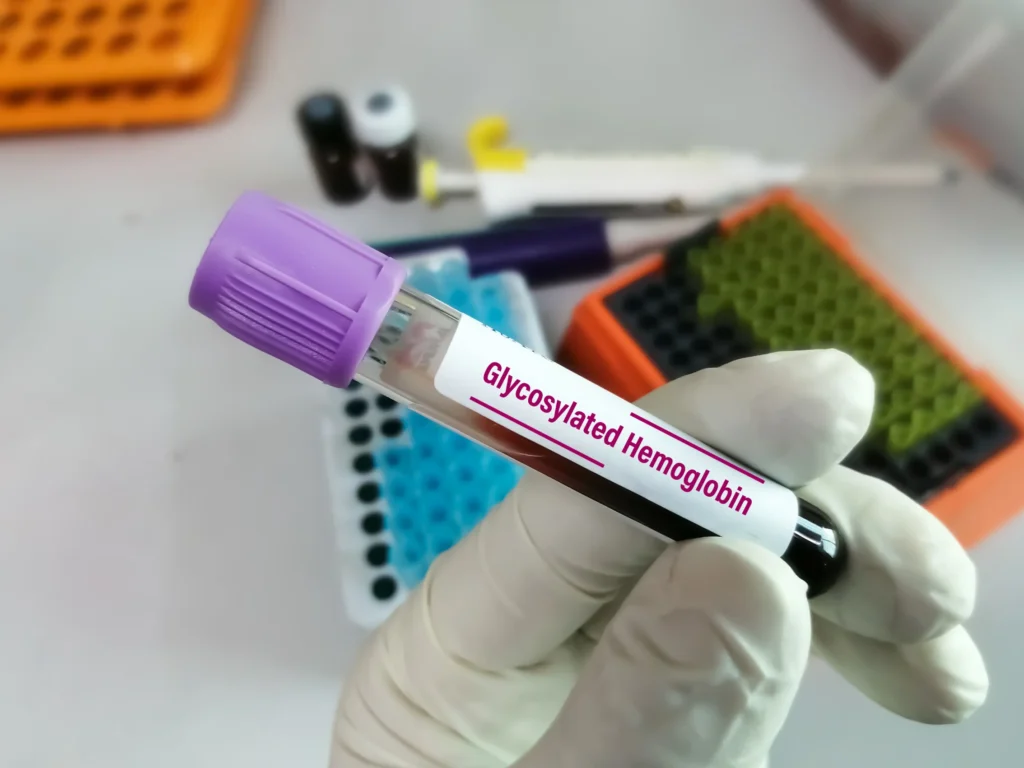 perfil diabético salud digna
